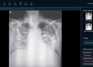 Romanian startup XVision offers doctors its AI analysis system to help diagnose COVID-19 faster